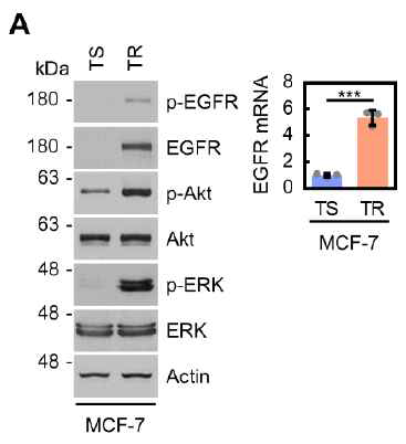 타목시펜 저항성 세포주에서 EGFR 신호 증가의 확인