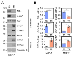 타목시펜 저항성 유도 세포 (TR)에서 CCN, 1 (CYR61), 2 (CTGF) 단백질의 과발현 확인
