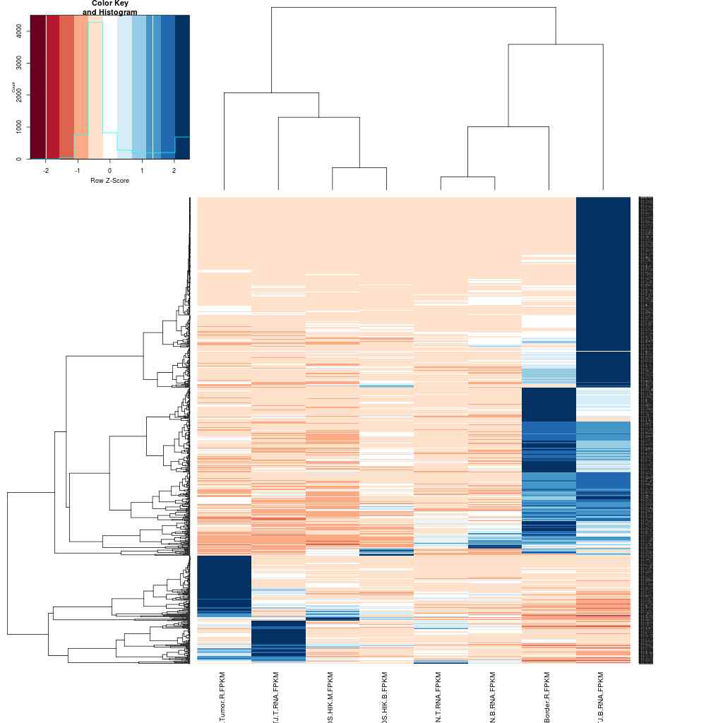 총 4례의 환자 differentially expressed genes (DEG)의 heat