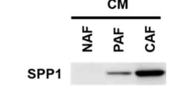 CM SPP1 Western blot 결과