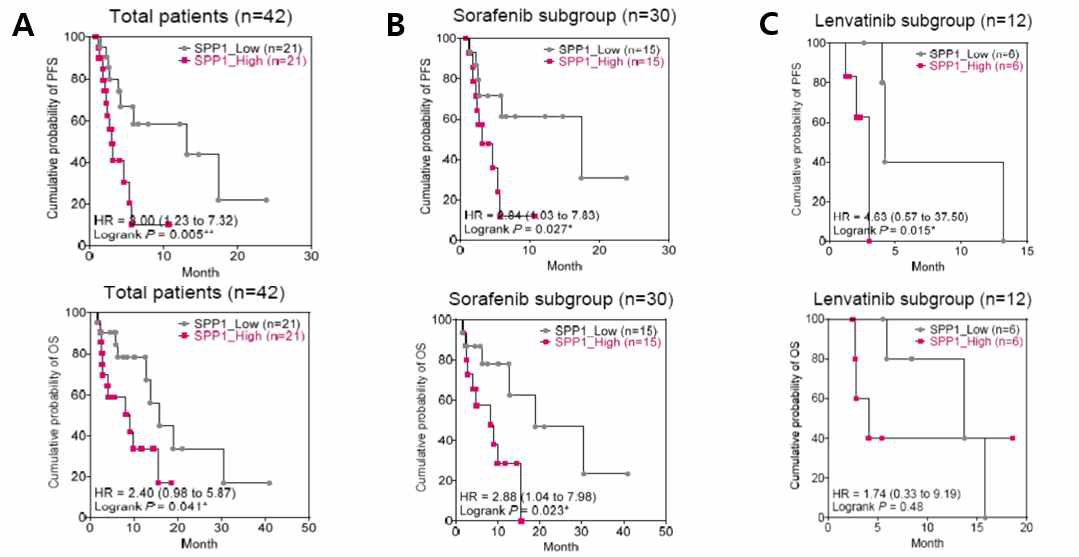 진행성 간암 환자 치료전 혈장 SPP1에 따른 progression free survival (PFS) 및 Overall survivasl (OS) 분석