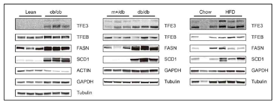 Expression of TFE3 in the liver of metabolic disease model mice
