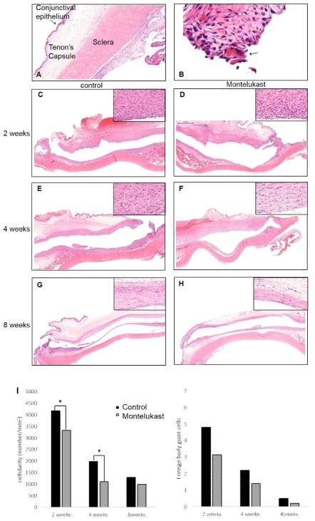 H&E stain 결과. 녹내장 방수유출장치 삽입술 후 2주, 4주째 cellularity가 적은 것을 확인할 수 있었음