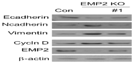 A549 세포주에서 확보된 화합물을 처리하여 EMT 마커, 증식 마커(cyclin D), EMP2의 발현정도