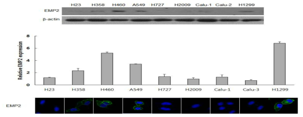 비소세포폐암 세포주에서 EMP2의 발현정도 (단백질, mRNA 수준(real time PCR), 면역세포화학염색)