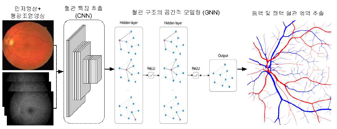 제안하는 연구의 개요. 안저영상과 형광조영영상의 통합 입력 영상에 대해 CNN과 GNN을 통합한 인공지능적 기법을 적용하여 동맥 및 정맥의 혈관 영역을 정밀하게 추출하는 기법을 개발함