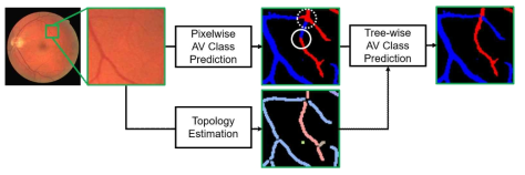 픽셀별 동정맥 추정과 혈관 형태 추정을 통합하여 트리 단위로 혈관 구조를 추정하는 개발 기법의 개념도