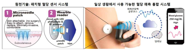 본연구의 개념도. 마이크로니들 기반 패치형 혈당 센서를 개발하고 센서 신호를 읽는 웨어러블 시스템과 데이터를 모니터하는 앱을 개발하여 글루코스 모니터링 시스템을 구축하였음