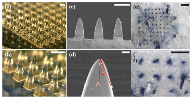 (a-d) 제작된 마이크로니들과 (e,f) 마이크로니들의 관통성 실험 결과. 돼지 피부의 표피를 뚫은 것을 염색된 결과로 알 수 있음