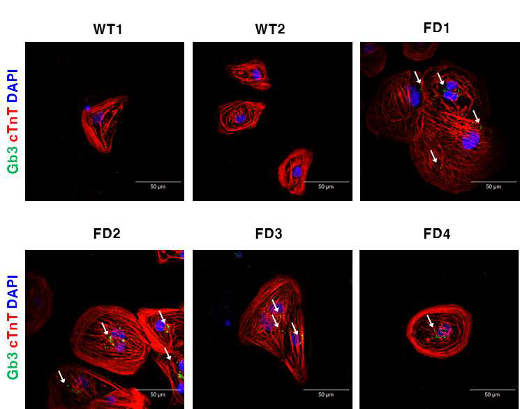 역분화줄기세포에서 분화한 심장근세포에서의 심장 특이적 근절 단백질 발현 및 Gb3의 축적