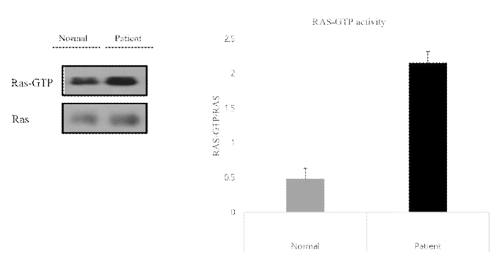 환자의 섬유아세포에서 RAS-GTP가 항진되어 있음을 발견하여, ARID2와 Ras-MAPK pathway의 연관성을 검증
