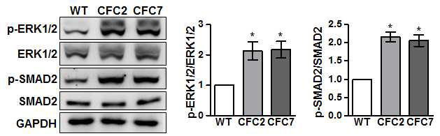 CFC 증후군 조골세포에서 나타나는 TGF-beta 및 ERK 신호전달체계의 과활성화