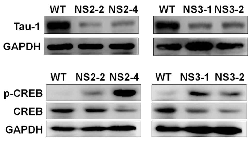 누난 증후군 환자 유래 신경계 세포에서 Tau-1 단백질 발현 및 p-CREB 활성 증가