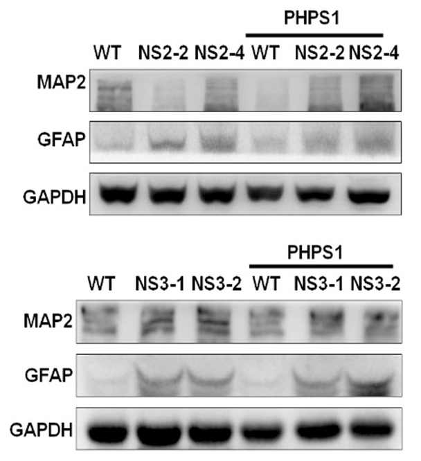 누난 증후군 환자 유래 신경계 세포에서 GFAP 단백질의 증가