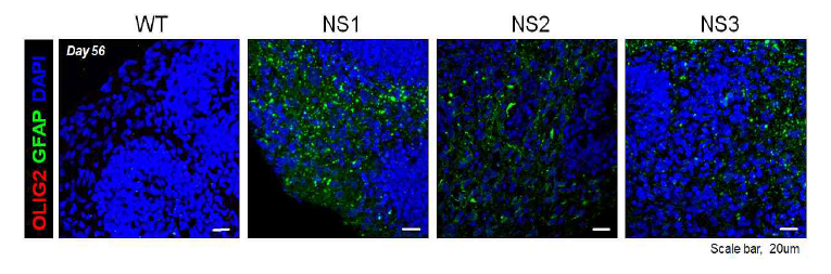 누난 증후군 환자 유래 대뇌 오가노이드에서 Olig2 마커를 이용해 희돌기교세포전구체의 분화 여부 확인