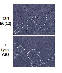 정상의 혈관내피세포에 LYSO-GB3를 처리하였을 때 나타나는 형태학적 변화