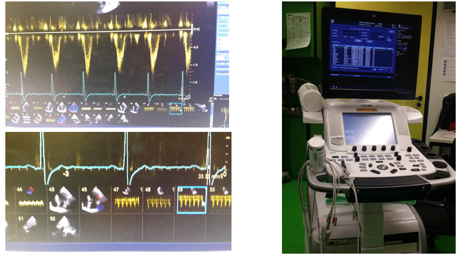 비교연구 수행을 위한 초음파도플러 화면과 비교연구장비