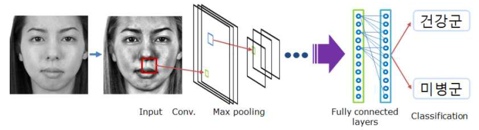 안면영상을 이용한 딥러닝 기반 미병분류