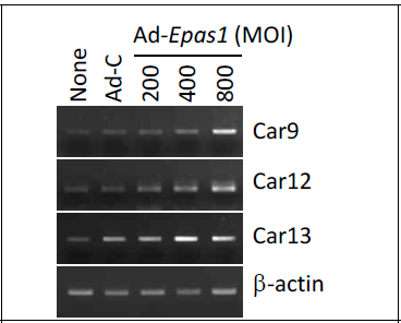 연골세포에서 HIF-2α 과발현 의한 carbonic anhydrase 9, 12, 13 발현