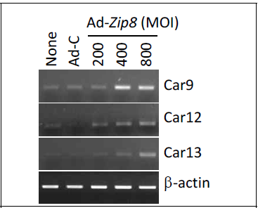 연골세포에서 ZIP8 과발현 의한 carbonic anhydrase 9, 12, 13 발현