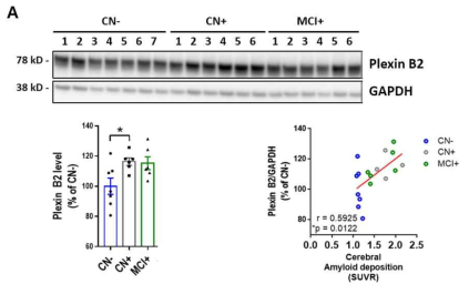 Plexin B2발현과 뇌아밀로이드 베타 축적과의 상관관계