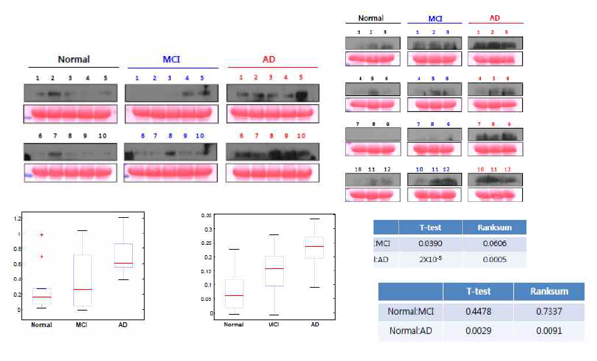 Western blot analysis 이용한 바이오마커 후보물질의 혈중 정량 방법 확립