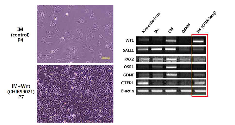만능성 세포 유래 신장전구세포의 배양 조건 연구 1 (IM 세포의 wnt 신호 조절)