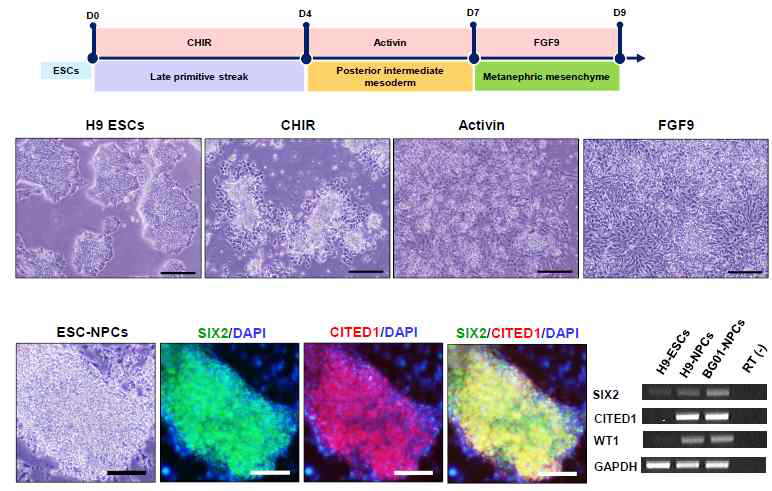 배아줄기세포로부터 유도된 신장전구세포 SIX2와 CITED1 발현을 면역염색법과 웨스턴 분석으로 확인