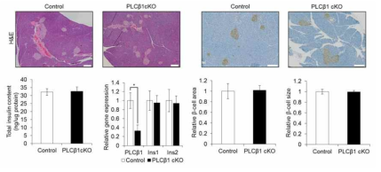 췌장 특이적 PLCβ1 결핍 마우스에 인슐린 분비 합성과 랑게르 한스섬과 췌장 베타세포 구조적 문제적의 차이가 없음