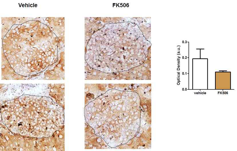FK506 투여에 의한 in vivo islet mitochondrial function의 감소. 50 mg/kg FK506을 8 주간 투여후 pancreas islet section에서 COX staining 시행 (left) 후 densitometry (right)