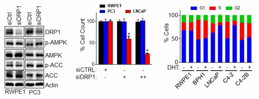 DRP1 저해에 따른 암세포 특이적인 G1 cell cycle arrest