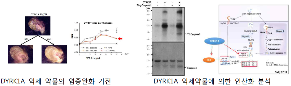 DYRK1A 억제 약물 분자기전