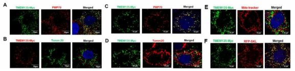 RPE1 (A&B)과 Huh7(C&D)세포에서 TMEM135-Myc표지로 퍼록시좀 세포소기관 단백 위치확인