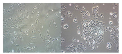 NIH/3T3(좌)와 KERA-308(우) 세포 이미지
