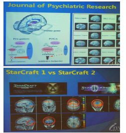 인터넷 게임 중독환자의 뇌와 프로게이머의 뇌 비교