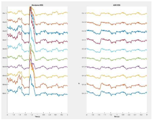 Bandpass filter를 적용한 EEG(좌) 와 ASR을 적용한 EEG(우) 비교