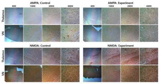 정상상태(Control)와 동물모델(Experiment)을 이용한 신경전달물질 수용기 변화측정