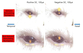 갈바닉 자극에 대한 눈 움직임 반응