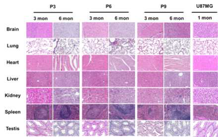 신경줄기세포를 이식한 후 3, 6개월째 뇌 및 다른 장기별 H&E 염색 결과. U87MG는 뇌교모세포종으로 양성대조군으로 사용됨