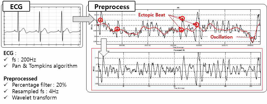 Heart Rate Variability(심박변이도) Pre-Processing