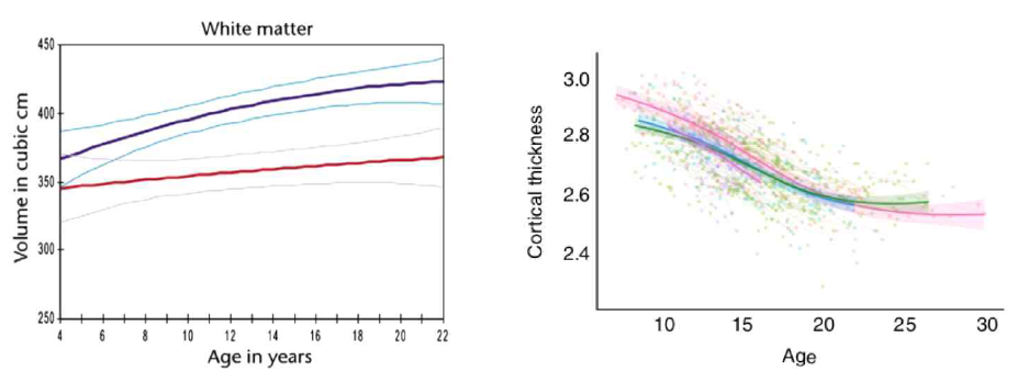뇌발달에 따른 백질의 변화와 피질두께의 변화 비교