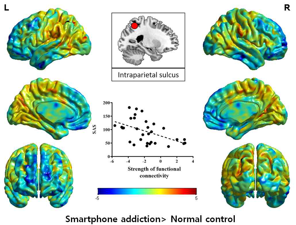 스마트폰 과의존과 내측두엽-전두엽간 뇌기능연결성 지표의 상관관계