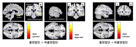 흡연 집단과 IGD 척도 점수 간 상호작용을 보이는 영역