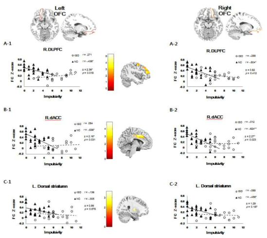 좌측과 우측 OFC에서 DLPFC, dACC, striatum으로의 연결성에서 나타나는 z값과 충동성 점수의 상관