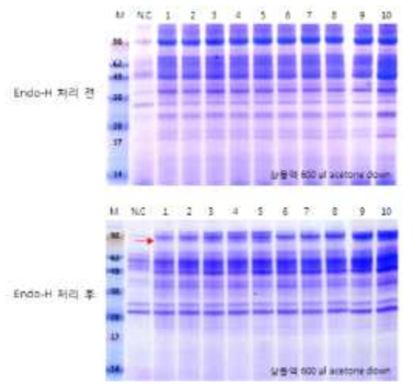 형질전환체들의 SDS-PAGE 분석