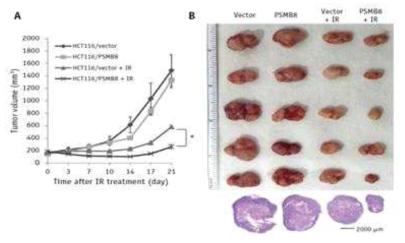 Effect of PSMB8 overexpression on the radiosensitivity of mouse xenograft tumors