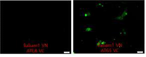 BiFC를 이용한 Babam1과 ATG5 결합 검증 (좌)