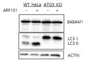 ATG5 KO 세포주에서 Babam1 분해 가능성 조사 (우)