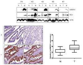 대장암 조직에서 Pex1과 hnRNPA1 발현 패턴 분석 (좌)