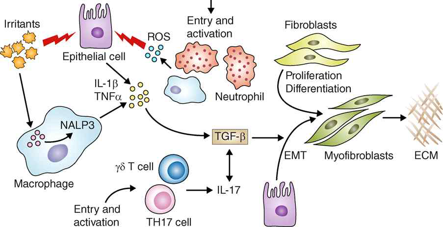 자극제 (블레오마이신 등)에 의한 섬유화 유도 기전: 섬유화 과정에서 면역세포의 참여 및 핵심 사이토카인 TGF-β의 역할